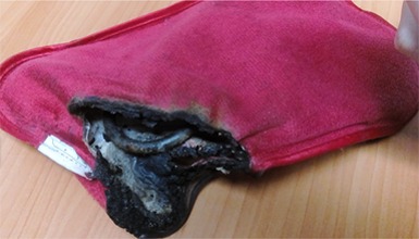 SEC suspende la venta de guateros eléctricos ante nuevo caso de inflamación